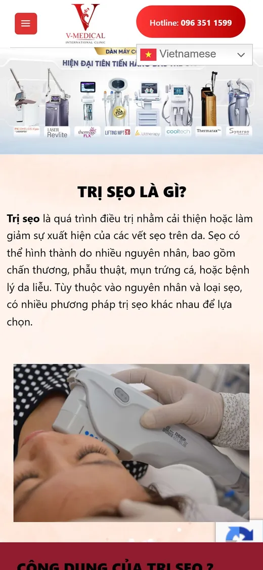 V-Medical Clinic trên điện thoại: Trị sẹo